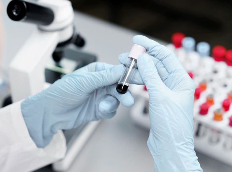 Chỉ số CRP bao nhiêu là nguy hiểm? Yếu tố nào ảnh hưởng đến chỉ số này